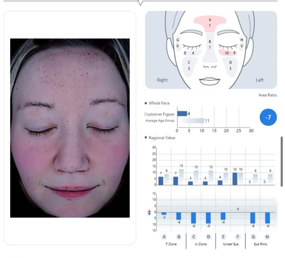Skin Age Analysis: ChatGPT Explores My Korean Janus Pro Report | Somewhere with Sora